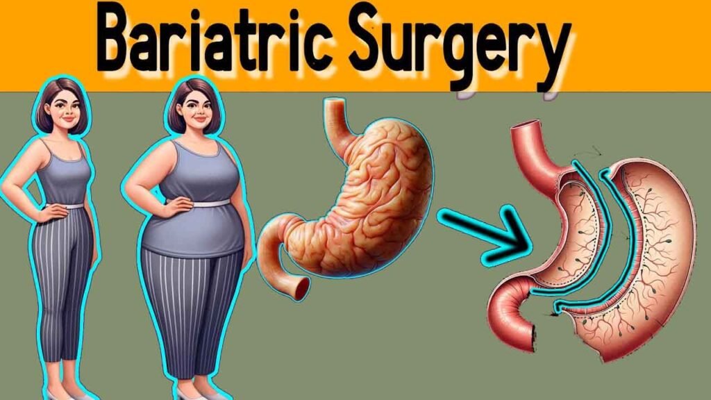 bariatric surgery weight loss calculator tool